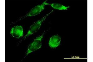 Immunofluorescence of purified MaxPab antibody to PECI on HeLa cell. (PECI/ECI2 抗体  (AA 1-364))