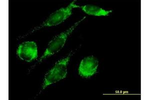 Immunofluorescence of purified MaxPab antibody to PECI on HeLa cell. (PECI/ECI2 抗体  (AA 1-364))