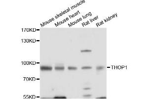 Western blot analysis of extracts of various cell lines, using THOP1 antibody. (Thimet Oligopeptidase 1 抗体)