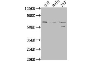 Western Blot Positive WB detected in: U87 whole cell lysate, Hela whole cell lysate, 293 whole cell lysate All lanes: PTGS2 antibody at 1:1000 Secondary Goat polyclonal to rabbit IgG at 1/50000 dilution Predicted band size: 69 kDa Observed band size: 69 kDa