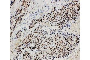 Immunohistochemistry (IHC) image for anti-Minichromosome Maintenance Complex Component 3 (MCM3) (AA 13-27), (N-Term) antibody (ABIN3044243)