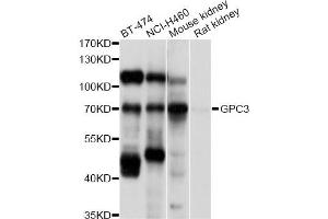 Western blot analysis of extracts of various cell lines, using GPC3 antibody (ABIN5997818) at 1/1000 dilution. (Glypican 3 抗体)