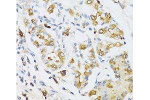 Immunohistochemistry of paraffin-embedded Human stomach using RNASE3 Polyclonal Antibody at dilution of 1:100 (40x lens). (RNASE3 抗体)