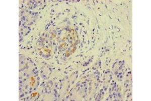 Immunohistochemistry of paraffin-embedded human pancreatic tissue using ABIN7157290 at dilution of 1:100 (KLHL3 抗体  (AA 1-301))
