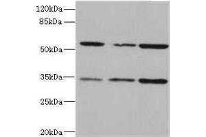 Western blot All lanes: IL17RB antibody at 2. (IL17 Receptor B 抗体  (AA 18-292))
