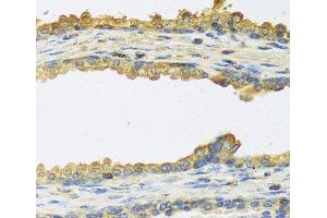 Immunohistochemistry of paraffin-embedded Human prostate using TSHB Polyclonal Antibody at dilution of 1:100 (40x lens). (TSHB 抗体)