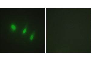 Peptide - +Western blot analysis of extracts from K562 cells, using FOXO4 (Ab-451) antibody. (FOXO4 抗体)