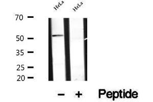Western blot analysis of extracts of HeLa cells, using Secretogranin III antibody. (SCG3 抗体  (Internal Region))