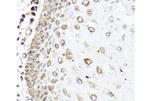 Immunohistochemistry (Paraffin-embedded Sections) (IHC (p)) image for anti-Ras-Related C3 Botulinum Toxin Substrate 2 (Rho Family, Small GTP Binding Protein Rac2) (RAC2) antibody (ABIN7255610)