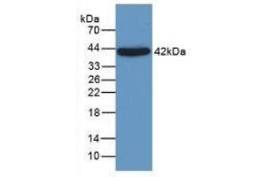 Detection of a1AGP in Rat Liver Tissue using Monoclonal Antibody to Alpha-1-Acid Glycoprotein (a1AGP) (ORM1 抗体  (AA 19-201))