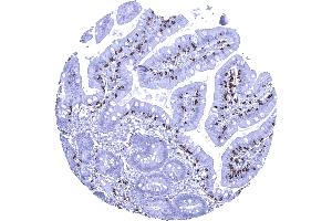 Duodenum mucosa Duodenal mucosa containing numerous intraepithelial CD8 positive lymphocytes (Recombinant CD8 抗体  (AA 135-235))