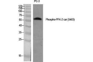 Western Blot (WB) analysis of specific cells using Phospho-PFK-2 car (S483) Polyclonal Antibody. (PFKFB2 抗体  (pSer483))