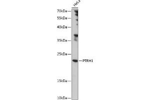 Western blot analysis of extracts of HeLa cells, using PTRH1 antibody (ABIN7269210) at 1:1000 dilution. (PTRH1 抗体  (AA 1-214))