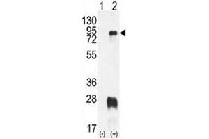 Western blot analysis of PRMT7 antibody and 293 cell lysate either nontransfected (Lane 1) or transiently transfected with the PRMT7 gene (2). (PRMT7 抗体  (AA 1-30))