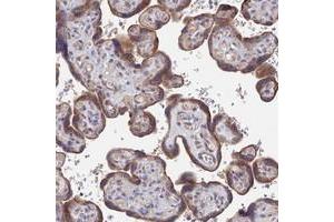 Immunohistochemical staining of human placenta with ZNF320 polyclonal antibody  shows moderate cytoplasmic positivity in trophoblastic cells.