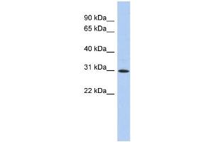WB Suggested Anti-ZNF771 Antibody Titration:  0. (ZNF771 抗体  (N-Term))