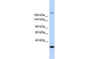 WB Suggested Anti-UTY Antibody Titration: 0. (UTY 抗体  (Middle Region))