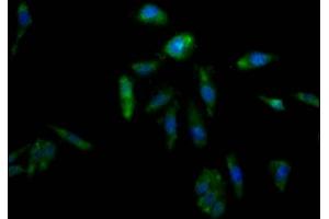 Immunofluorescence staining of Hela Cells with ABIN7127330 at 1:50, counter-stained with DAPI. (Recombinant AKR1C3 抗体)
