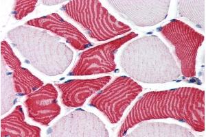 Immunohistochemistry (IHC) image for anti-Estrogen Receptor Binding Site Associated, Antigen, 9 (EBAG9) (C-Term) antibody (ABIN185657)