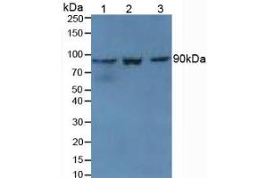 Western blot analysis of (1) Mouse Kidney Tissue, (2) Mouse Spleen Tissue and (3) Mouse Placenta Tissue. (TGM1 抗体  (AA 337-607))