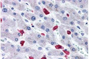 Human Liver (formalin-fixed, paraffin-embedded) stained with CD163 antibody ABIN337380 at 20 ug/ml followed by biotinylated goat anti-rabbit IgG secondary antibody ABIN481713, alkaline phosphatase-streptavidin and chromogen. (CD163 抗体  (N-Term))