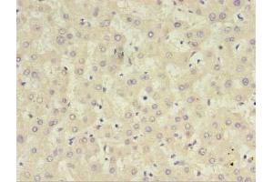 Immunohistochemistry of paraffin-embedded human liver tissue using ABIN7148394 at dilution of 1:100 (CFHR2 抗体  (AA 20-269))