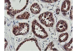 Image no. 9 for anti-CoA Synthase (COASY) antibody (ABIN1497556) (COASY 抗体)