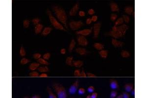 Immunofluorescence analysis of 293T cells using NAT2 Polyclonal Antibody at dilution of 1:100 (40x lens). (NAT2 抗体)