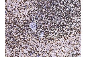 IHC analysis of RCC1 using anti-RCC1 antibody (ABIN7600022). (RCC1 抗体  (AA 14-421))