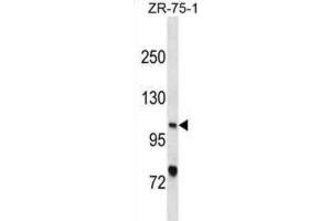 Western Blotting (WB) image for anti-Xeroderma Pigmentosum, Complementation Group C (XPC) antibody (ABIN3001097) (XPC 抗体)