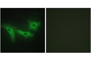 Immunofluorescence analysis of HeLa cells, using LRRK1 Antibody. (LRRK1 抗体  (AA 361-410))