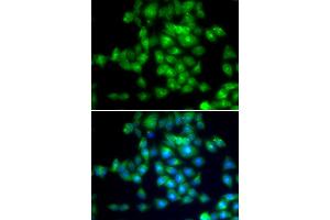 Immunofluorescence analysis of MCF7 cell using SIRT3 antibody. (SIRT3 抗体)