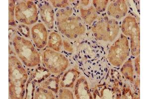 Immunohistochemistry of paraffin-embedded human kidney tissue using ABIN7143430 at dilution of 1:100 (Adrenomedullin 抗体  (AA 45-92))