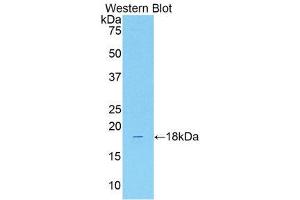 Western Blotting (WB) image for anti-Solute Carrier Family 12 (Sodium/Chloride Transporters), Member 3 (SLC12A3) (AA 3-146) antibody (ABIN1176282) (SLC12A3 抗体  (AA 3-146))