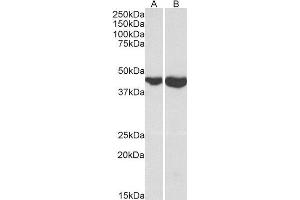 Western Blotting (WB) image for Glutamic-Oxaloacetic Transaminase 2, Mitochondrial (Aspartate Aminotransferase 2) (GOT2) (AA 295-306) peptide (ABIN369242)