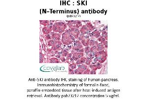 Image no. 1 for anti-SKI Proto-Oncogene (SKI) antibody (ABIN1739312) (SKI 抗体)