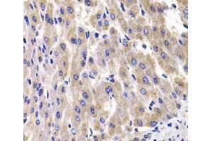 Immunohistochemistry of paraffin-embedded Rat liver using RPL14 Polyclonal Antibody at dilution of 1:100 (40x lens). (RPL14 抗体)
