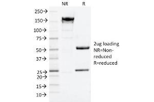 SDS-PAGE Analysis Purified NGFR Mouse Monoclonal Antibody (NGFR/1964). (NGFR 抗体  (AA 281-421))