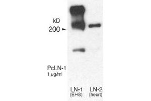 Western blot analysis of Lama1 using Lama1 polyclonal antibody . (Laminin alpha 1 抗体)