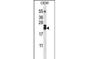 TNFSF4 Antibody (Center) (ABIN656220 and ABIN2845537) western blot analysis in CEM cell line lysates (35 μg/lane). (TNFSF4 抗体  (AA 102-131))