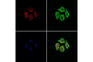 ABIN7094453 and ABIN7098501 staining Hela cells by IF/ICC. (LOX 抗体  (Internal Region))