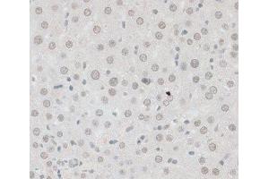 Immunohistochemistry of paraffin-embedded Rat liver using ZNF148 Polyclonal Antibody at dilution of 1:100 (40x lens). (ZNF148 抗体)