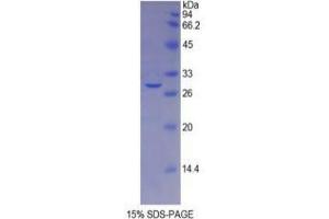 SDS-PAGE analysis of Mouse Galactosidase beta Protein. (GLB1 蛋白)