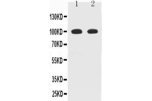 Observed bind size: 100KD (MAG 抗体  (N-Term))