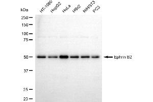 anti-Ephrin B2 (EFNB2) antibody