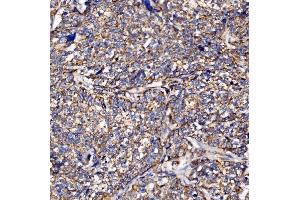 IHC analysis of PMPCA/INPP5 using anti-PMPCA/INPP5 antibody (ABIN7602722). (PMPCA 抗体  (AA 99-525))