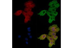 ABIN6256882 and ABIN6274575 staining Hela cells by IF/ICC.