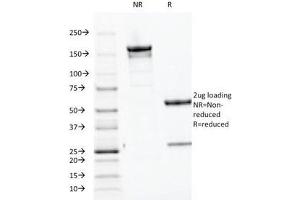 SDS-PAGE Analysis of Purified, BSA-Free Parathyroid Hormone Antibody (clone PTH/1174). (PTH 抗体  (AA 32-115))