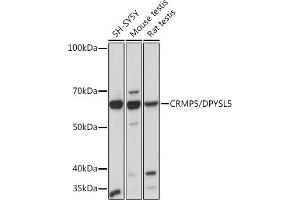 Western blot analysis of extracts of various cell lines, using CRMP5/DPYSL5 Rabbit mAb (ABIN7266774) at 1:1000 dilution. (DPYSL5 抗体)