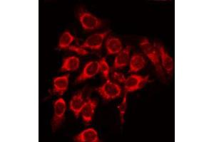 ABIN6268750 staining 293 by IF/ICC. (Patched 1 抗体)